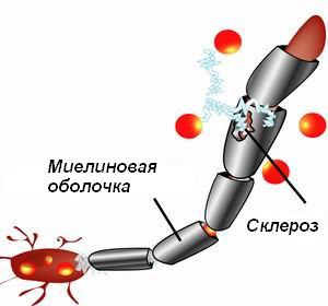 Склероз картинки прикольные